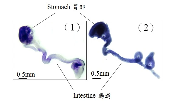 港大在先天性巨結腸症病人中發現影響腸神經細胞發育的新基因變異