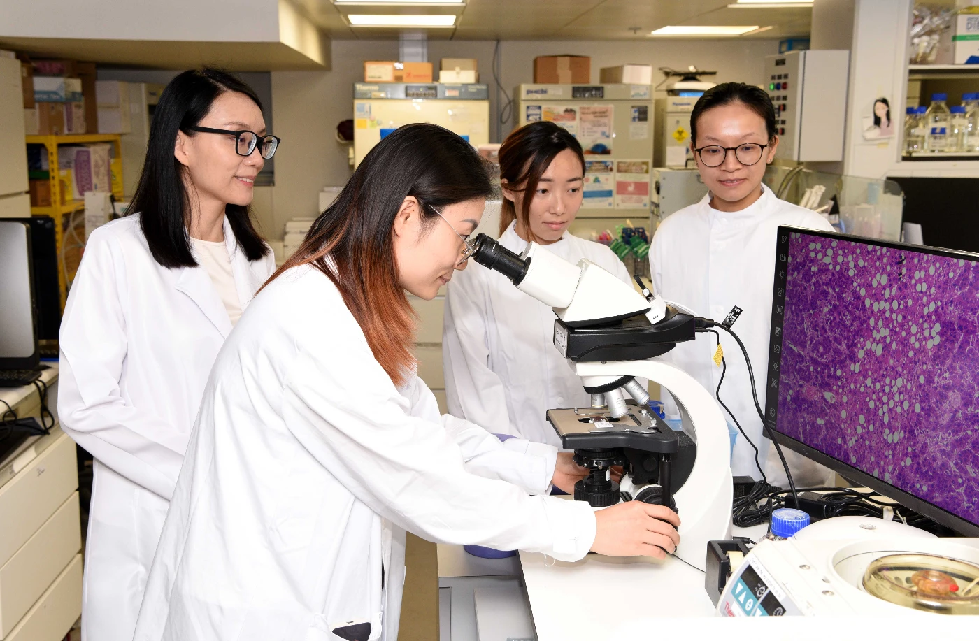 The HKUMed researchers have identified that liver cancer cells rely on the mevalonate pathway to shield themselves from programmed cell death. By blocking this pathway with atorvastatin, their key defenses could be effectively removed.
