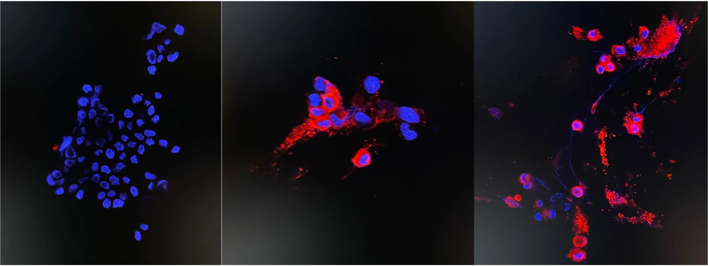 香港大學微生物系團隊成功分離及培養Omicron 病毒變種株