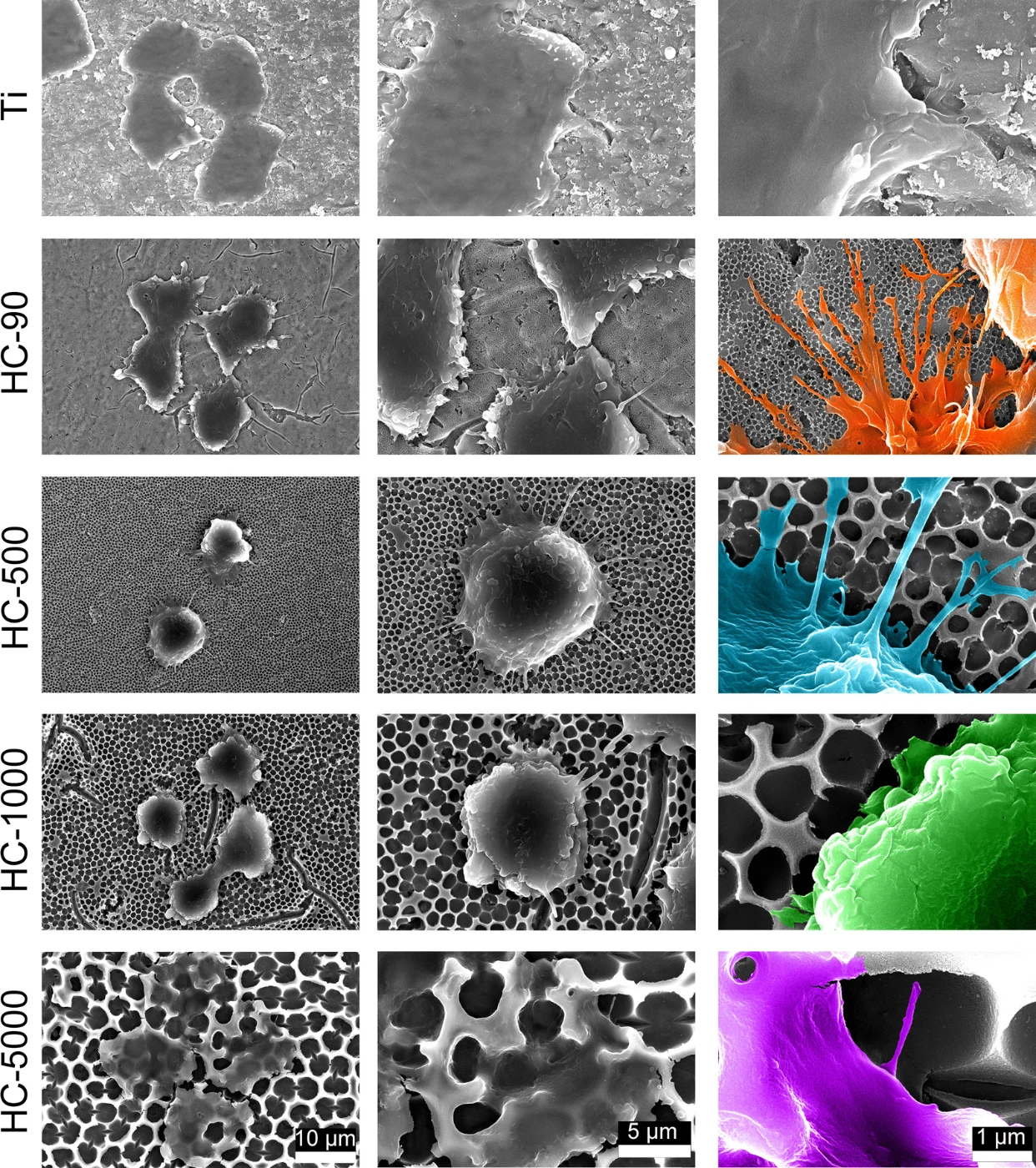 HKUMed designs a novel nanoscale surface structure to accelerate implant-to-bone integration through immune coordination