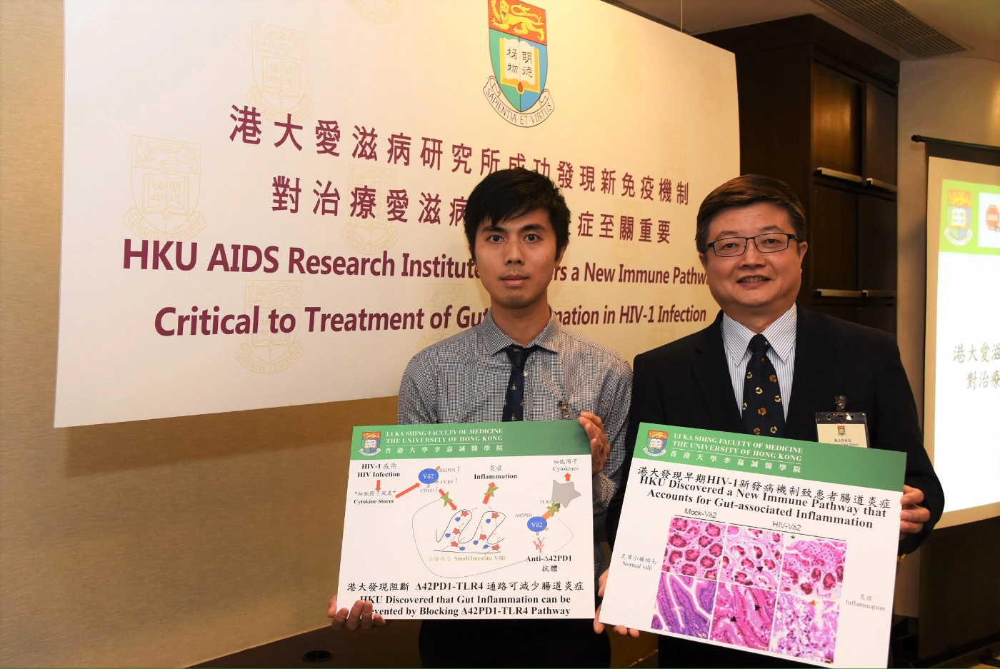 HKU AIDS Research Institute Discovers a New Immune Pathway <br>
Critical to Treatment of Gut Inflammation in HIV-1 Infection