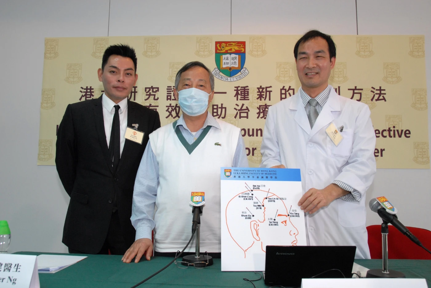 HKU study proves a novel acupuncture to be an effective additional therapy for major depressive disorder