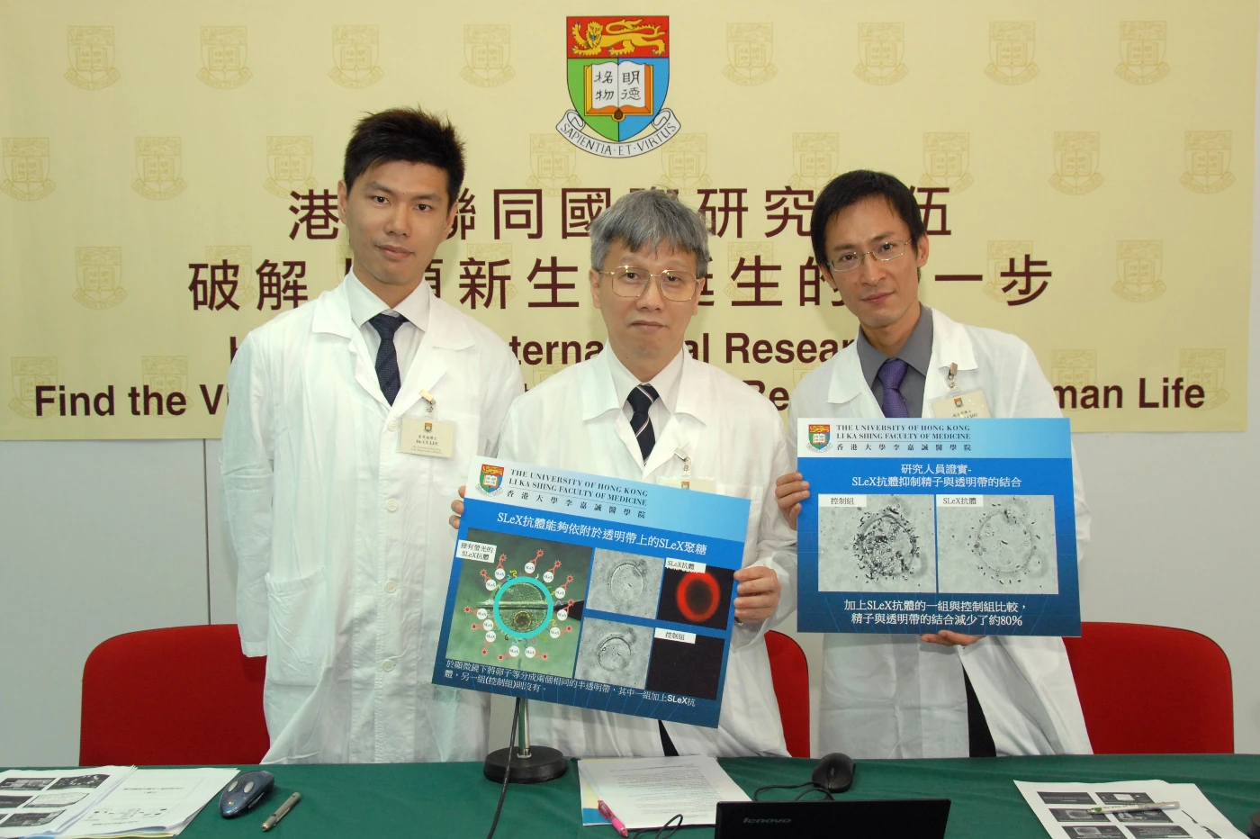 HKU with an international research team identifies the key molecule for sperm-egg binding - The vital process that marks the beginning of human life