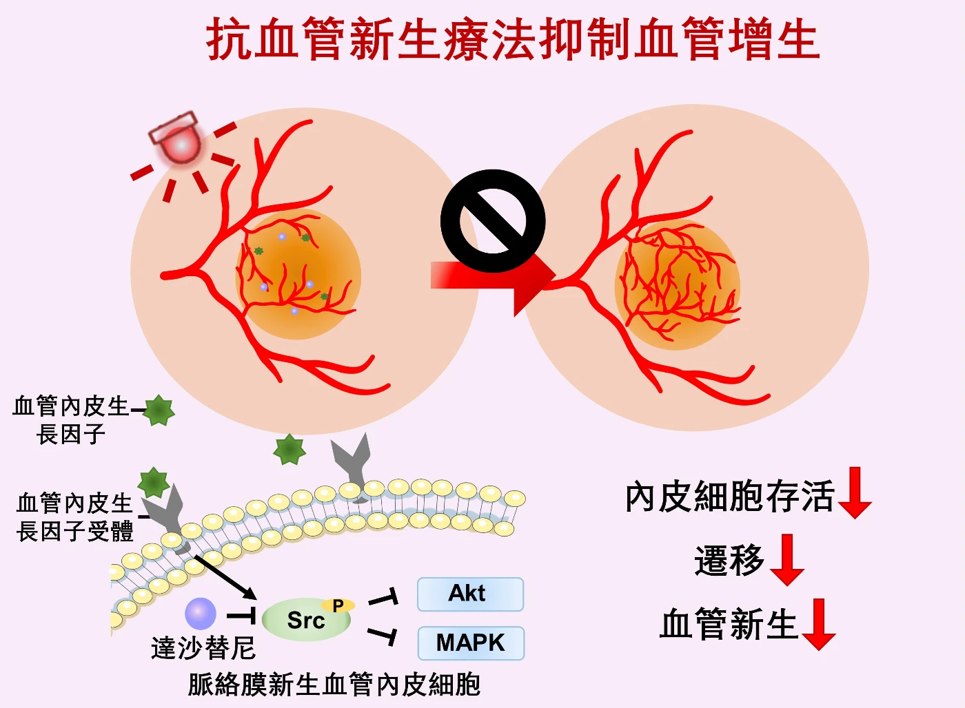 抗血管增生療法通過壓抑與血管內皮生長因子（VEGF）相關的路徑，抑制脈絡膜新生血管形成（CNV）。這項研究首次將抗血管增生藥物和光敏藥物結合製成納米製劑用於黃斑病變治療，為黃斑病變和其他新生血管性眼病的微創療法提供了新的方向。