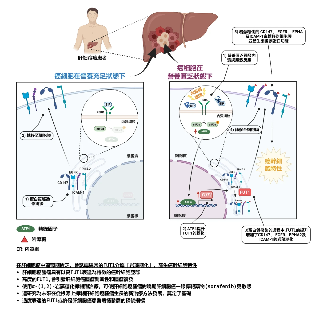 港大醫學院發現肝癌細胞耐藥性及腫瘤復發的新分子機制