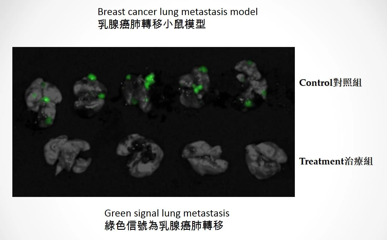 圖中顯示使用「YB1」治療乳腺癌肺轉移小鼠的情況，上方的綠色信號為對照組小鼠乳腺癌肺轉移的情況，而下方治療組小鼠以「YB1」治療後則沒有出現肺轉移，可見「YB1」能完全抑制腫瘤的肺轉移。