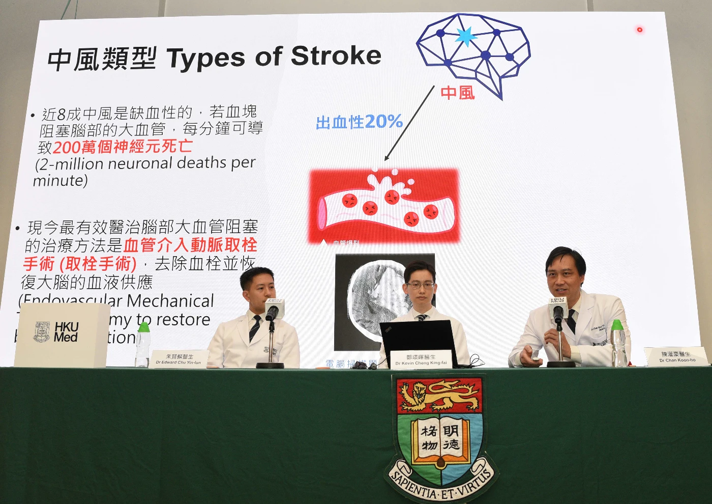 (From right) Dr Chan Koon-ho, Dr Kevin Cheng King-fai and Dr Edward Chu Yin-lun announce the clinical outcomes of their study. Extending the stroke treatment golden period from six hours to 24 hours has shown significant benefits for a larger number of patients.