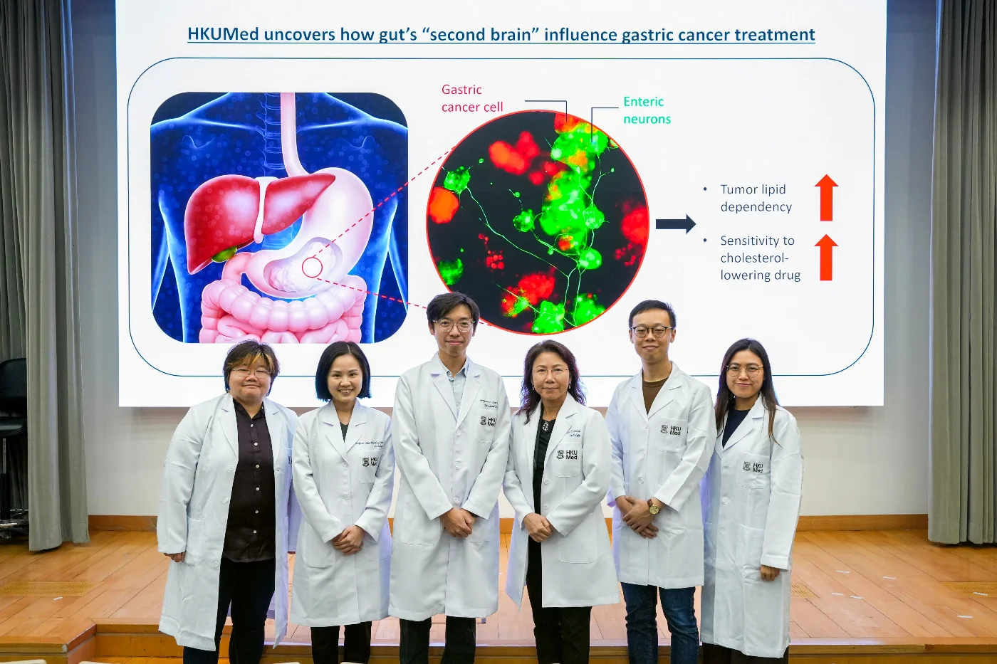 港大醫學院破解胃癌「代謝密碼」 <br>
胃癌腫瘤生長減緩達65% <br>
神經元滲透性胃癌配合膽固醇抑制劑 殺死癌細胞效果提高6.3倍