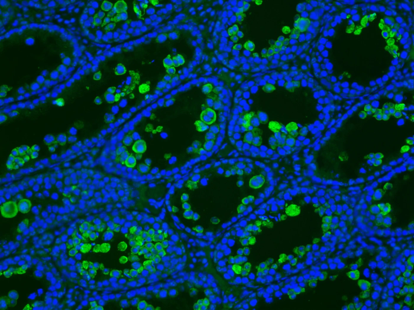 HKU Discovers Potential Treatments for Zika Virus Infection-Associated Complications