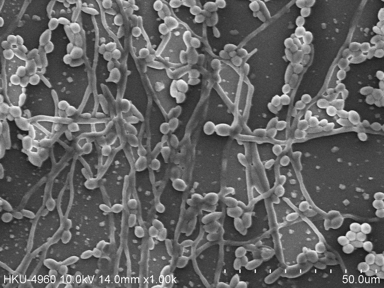 電子顯微鏡照片顯示白色念珠菌於塑料表面生成完整生物膜(圖左)；加入紅紫素則抑制生物膜形成(圖右)。