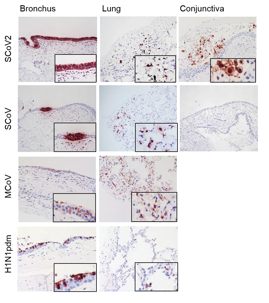 港大研究發現新型冠狀病毒（SARS-CoV-2）<br>
較引起「沙士」的冠狀病毒（SARS-CoV）更容易感染人類呼吸道及眼睛<br>
顯示眼睛可能是人類感染新型冠狀病毒的重要途徑