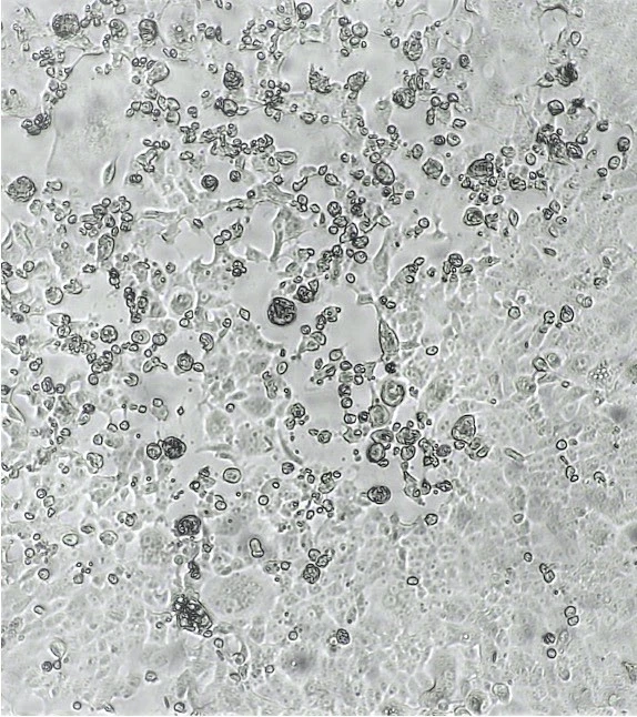 港大微生物學系團隊研究發現：兩針BNT162b2 （復必泰）或 Coronavac（科興）不足抵抗Omicron 病毒變體