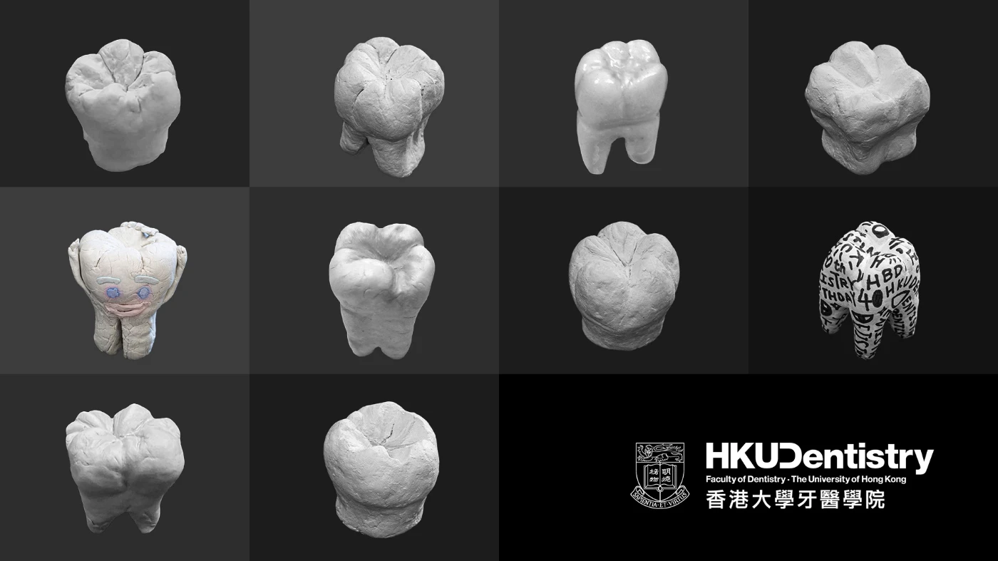 網上學習牙科的科學、藝術與科技<br>
中學生用黏土創作臼齒模型 – 首十名最佳作品