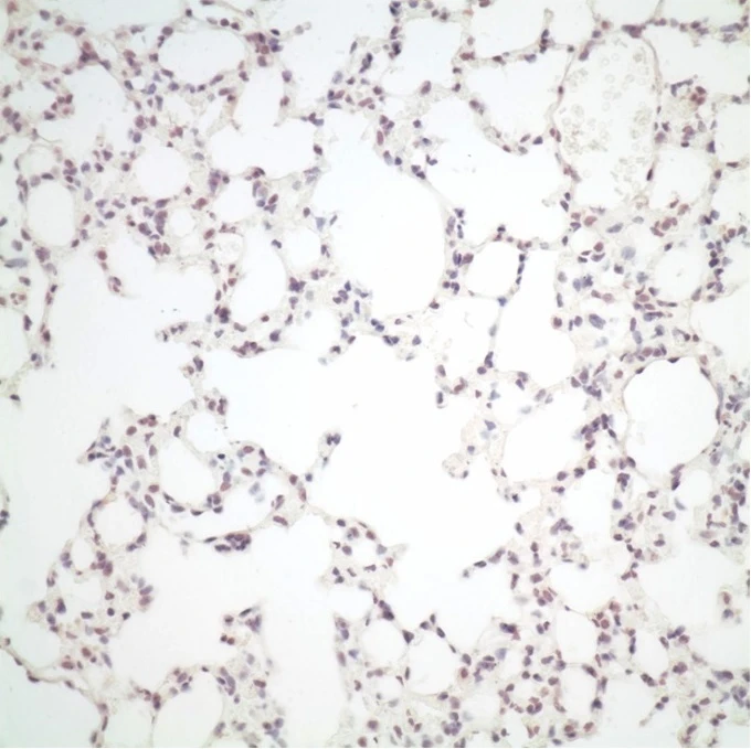 HKU medical research team finds host adaptation strategies of avian influenza A viruses for better replication in human