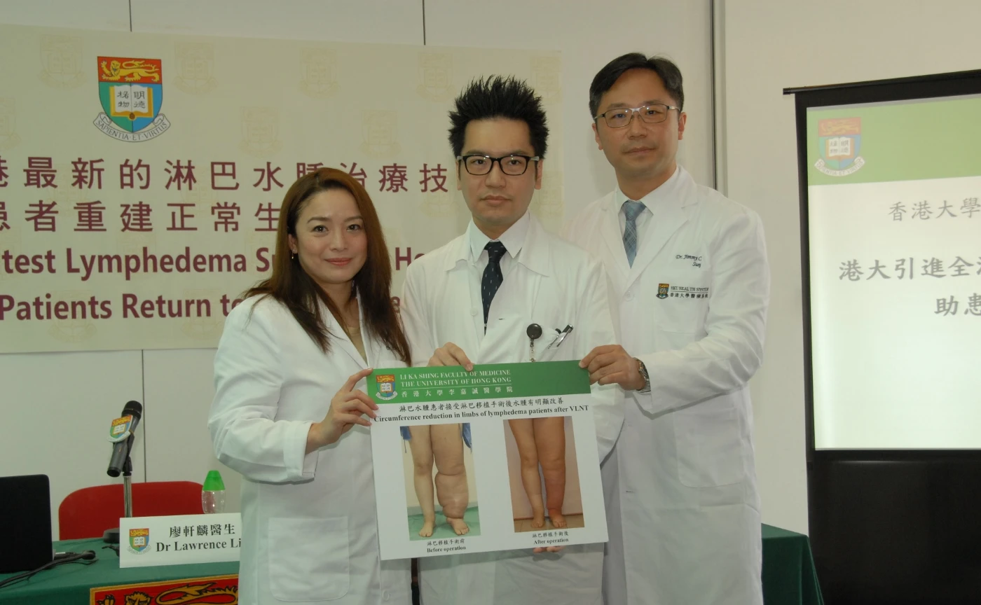 港大引進全港最新的淋巴水腫治療技術助患者重建正常生活