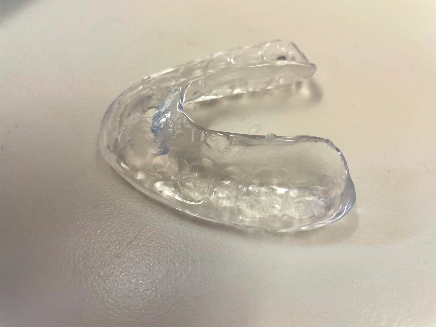 關節性牙骹痛通常由保守治療開始，病人會在晚上戴着咬合夾板（牙膠），以改善顳顎關節症。