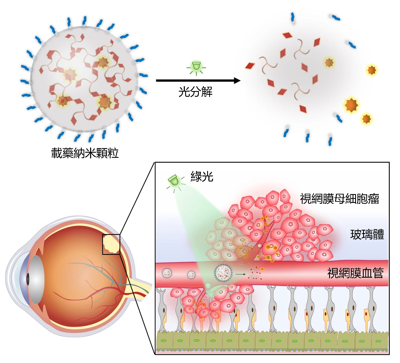 研究團隊設計了可被光分解的三枝狀小分子，該分子可以與疏水性藥物自發組裝成納米顆粒，並能在綠光照射下能分解及釋放藥物。在患有原位視網膜母細胞瘤的小鼠身上，透過靜脈注射納米顆粒並以綠光照射其眼部，可以有效抑制腫瘤生長，且未見毒副作用。