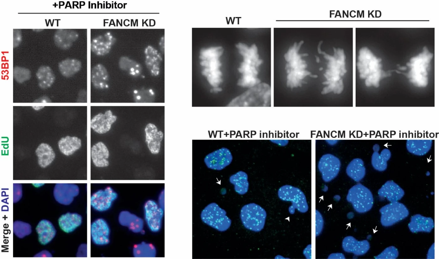 HKU Researchers Shed Light on Overcoming Cancer Drug Resistance<br>
Unlocking Potential to Expand Use of PARP Inhibitors Across Cancer Types